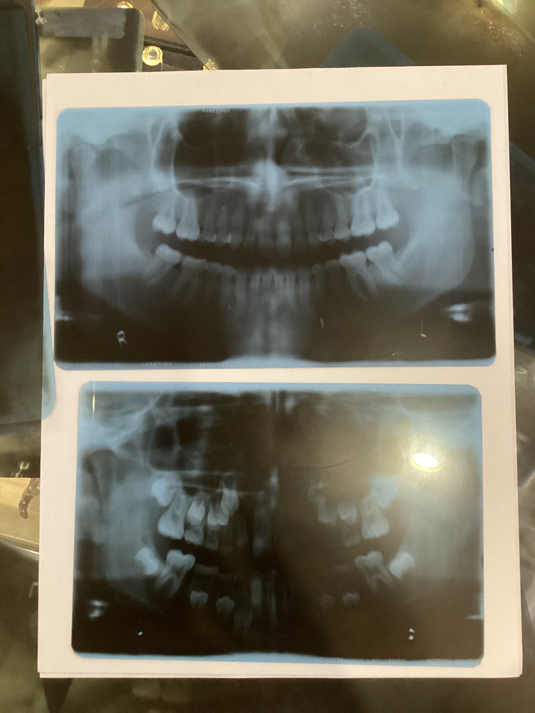 Dental X-Rays (Large)